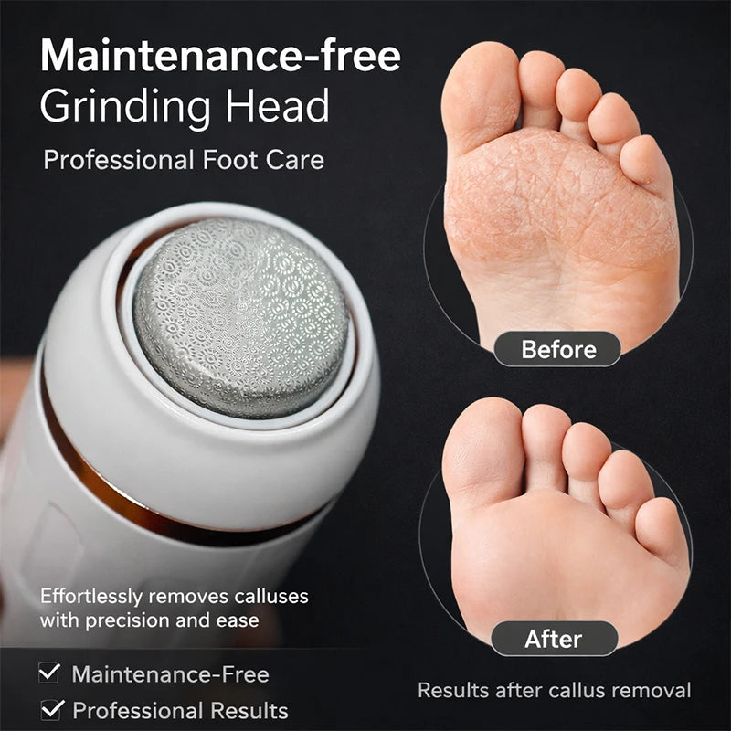 Râpe Électrique Anti-Callosités pour Pieds – Élimine Peaux Mortes et Corne - 3 Têtes Interchangeables OFFERTES
