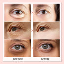 Crème réparatrice pour les yeux anti-cernes