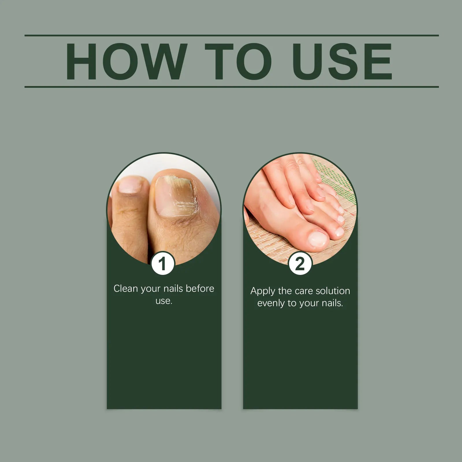 Soin des Ongles au Gingembre & Arbre à Thé Pour Ongles Jaunis, Décolorés ou Épaissis - Traitement Express 7 Jours - 1 acheté = 1 offert